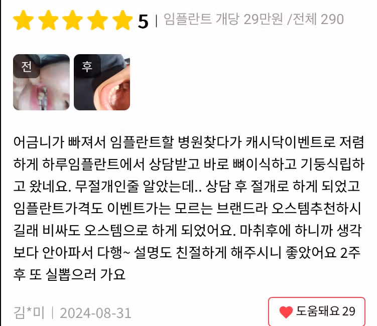 서초구 하루플란트치과 임플란트 개당 29만원/전체 290만원 후기 추천합니다