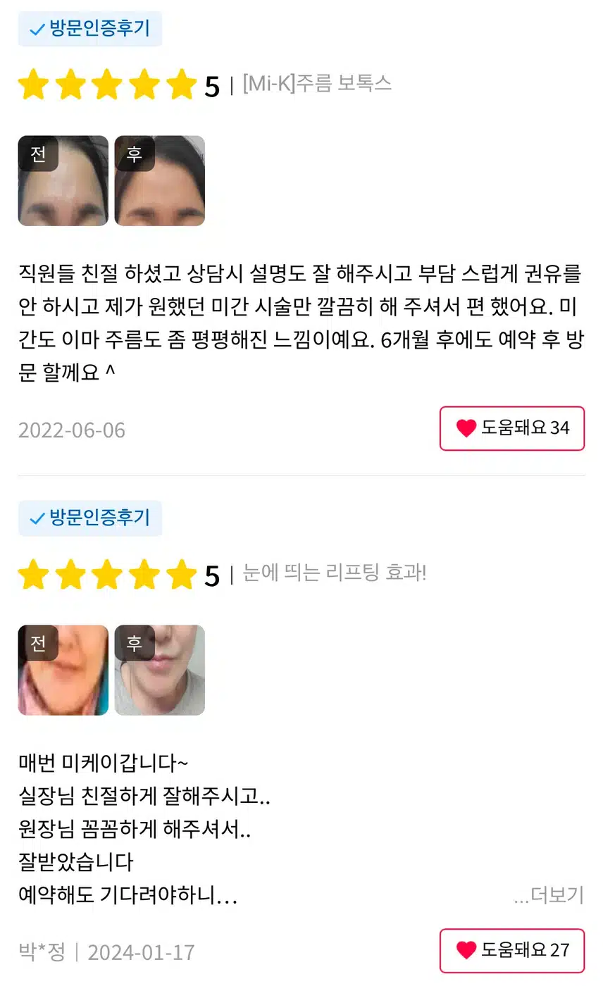 서초구 미케이의원 주름보톡스2.5만원 후기 추천해요~
