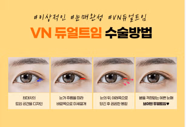 서울 서초구 VN 눈매확장 듀얼트임 후기 추천합니다