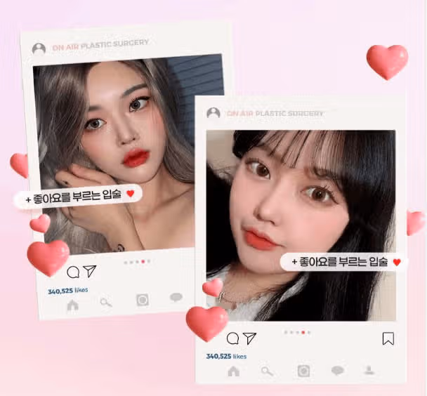 서울 강남구 온에어💋입술필러 후기 추천합니다