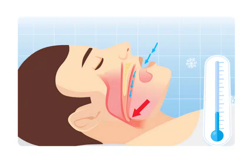 (질문)코콜이 어떻게 치료해야 할까요?? 