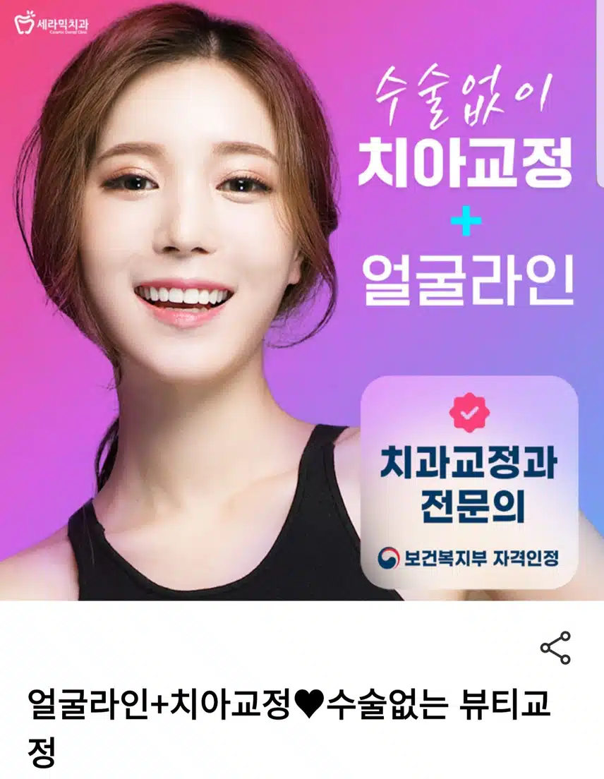 강남구 수술없이 치아교정 15만원 후기 