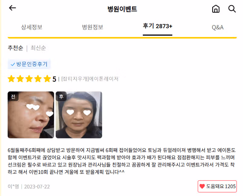 서초 에이톤레이저 9.9만원 후기