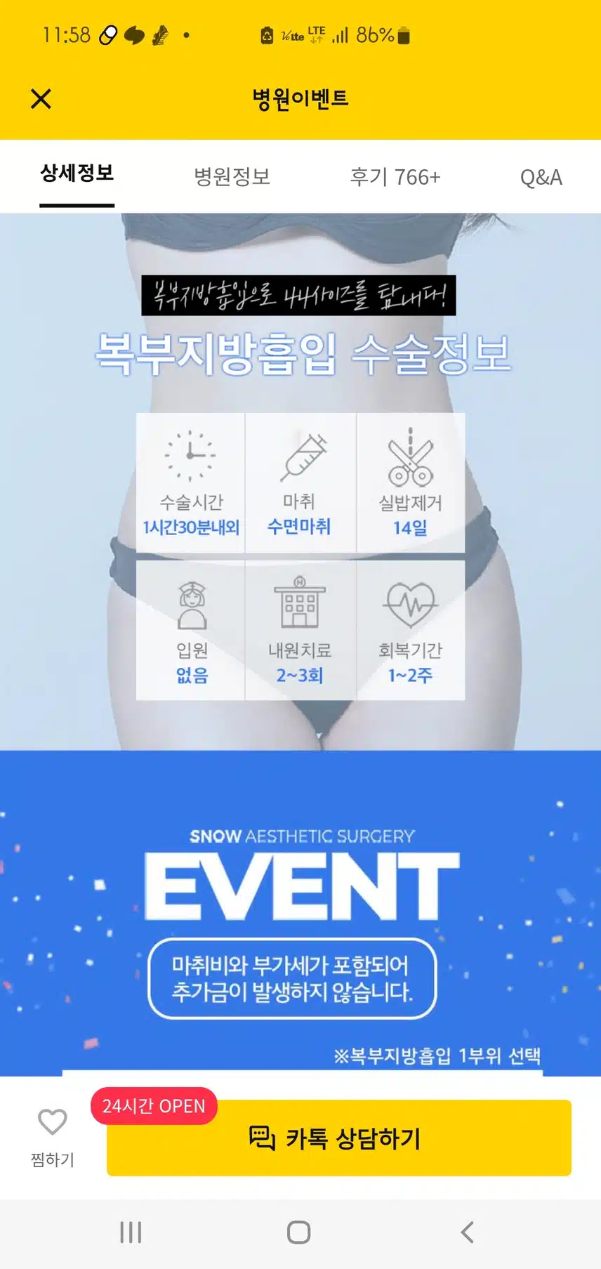 강남 대용량 복부지방흡입 55만원 후기입니당😃👍👍