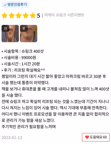 서울시 서초구 슈링크 유니버스 아이전용 후기