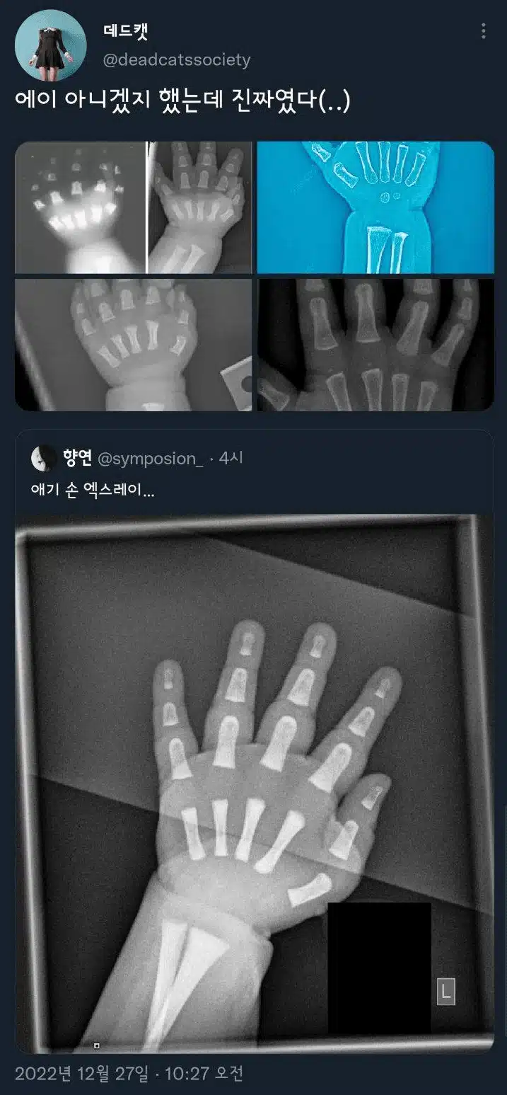 애기들이 통통한 이유