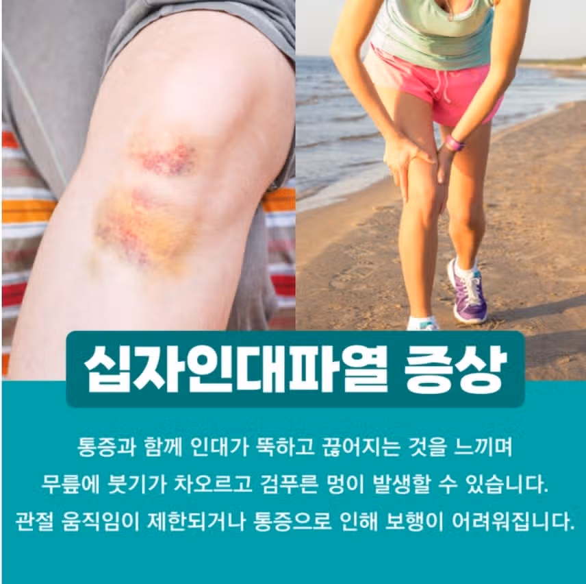 한달 전에 생긴 멍이 아직 안없어져서 걱정입니다