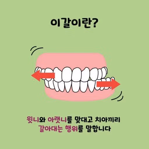 (질문)🦷치아 건강을 위협하는 이갈이 좋아지는 방법 있을까요? 
