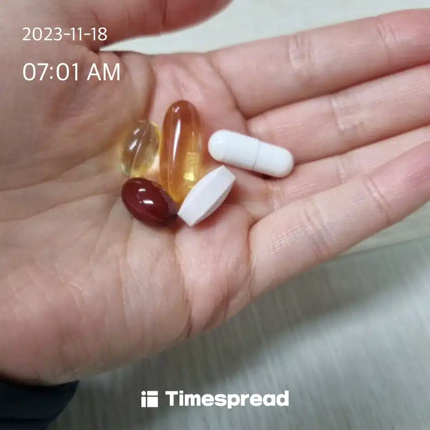 영양제 먹기 