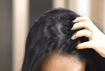 (질문) 흰머리 나기시작  왜? 간지러워요 