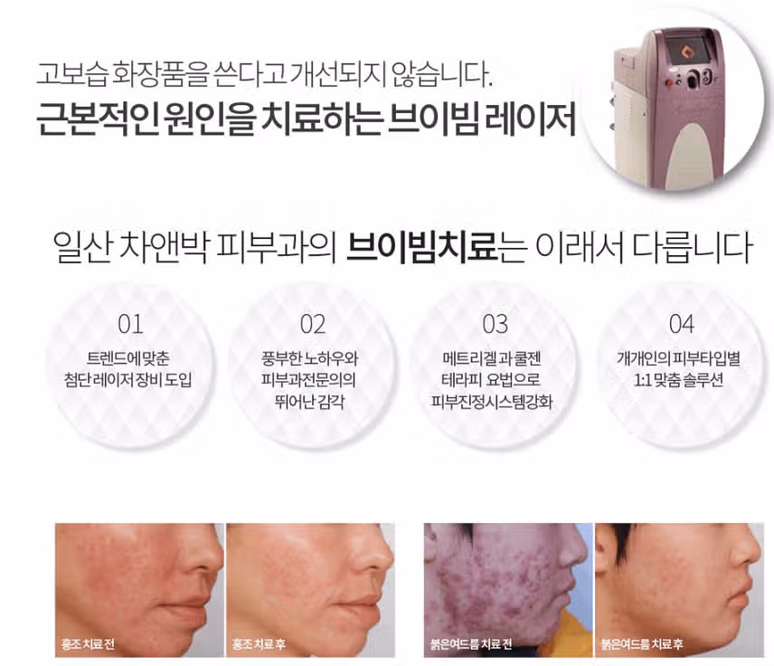 브이빔 효과 직접 경험해보니 확실히 달라요!