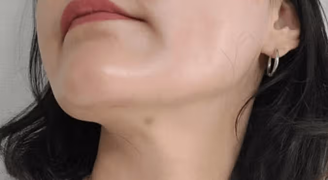 건대인모드 Fx 풀페이스 컷슬린 인젝션 이중턱뿌시기