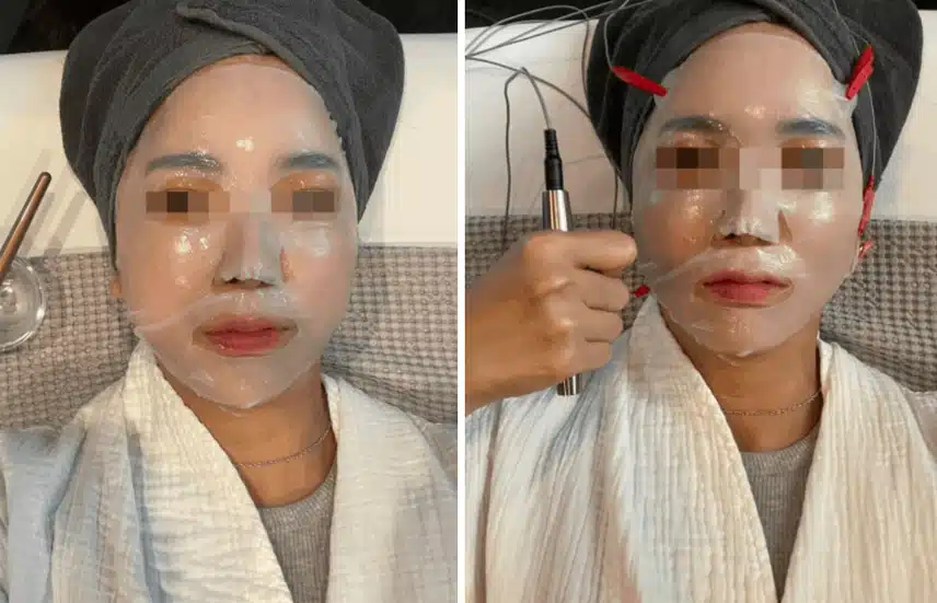 역삼역피부과 티타늄리프팅 잘하는 병원
