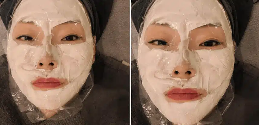 자양역피부과 모공관리 건대스킨보톡스 맛집