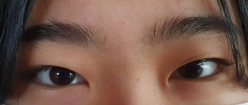 답답한 눈! 시원하게 찝었어요~