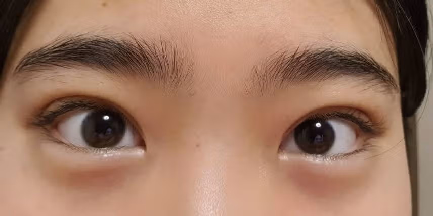 답답한 눈! 시원하게 찝었어요~