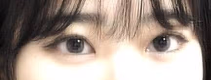 답답한 눈! 시원하게 찝었어요~