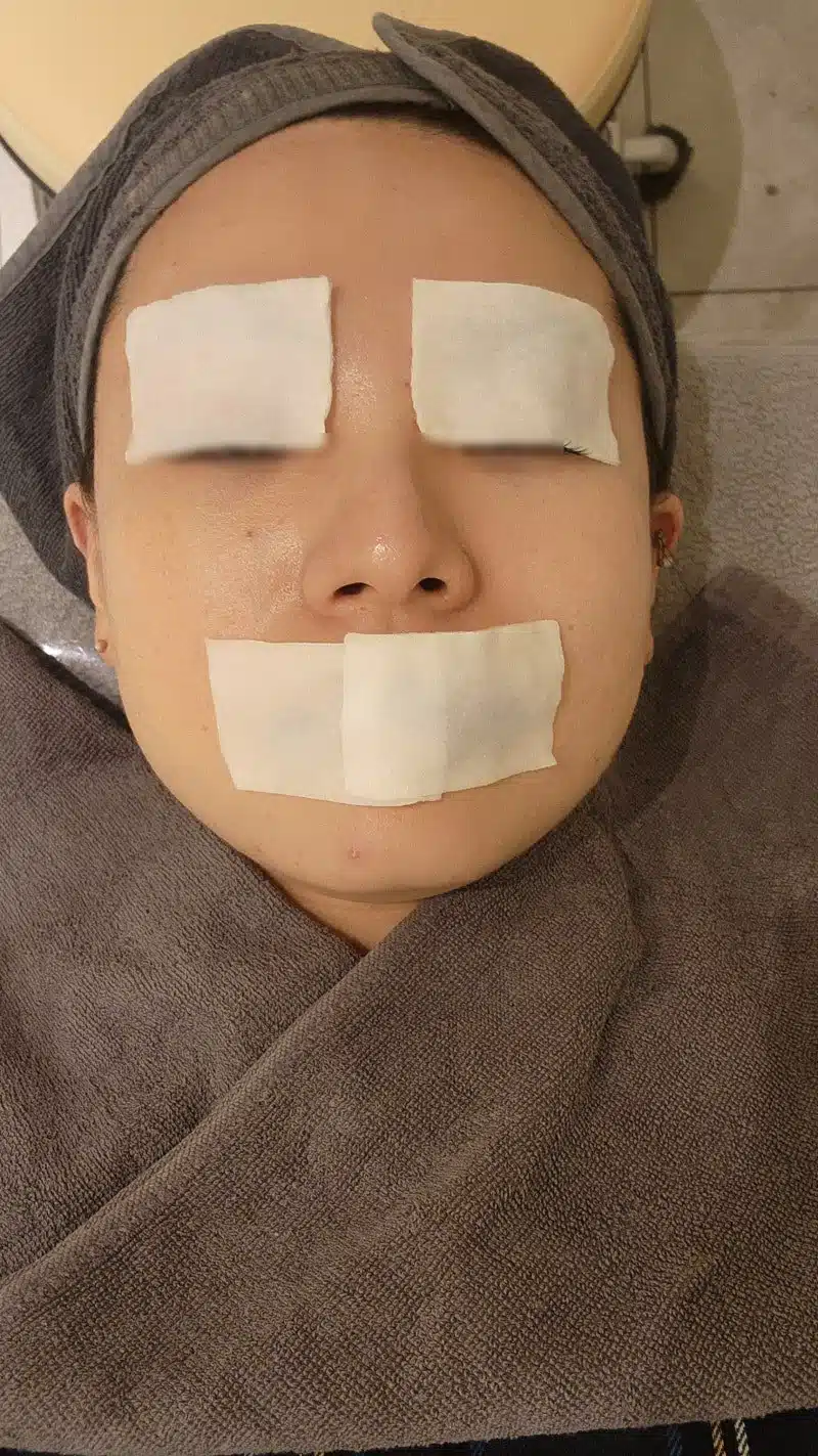 건대 리쥬란 HB 후기 – 자극 없는 수분·탄력 시술 체험기