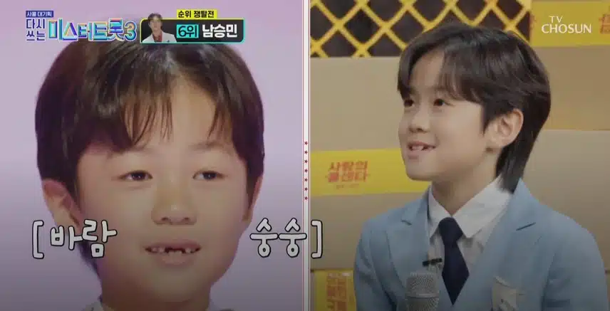 유지우 군의 최근 앞니 이슈ㅋㅋ