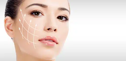 PDO 특징 완벽 정리 – PDO 실리프팅 실 종류와 효과
