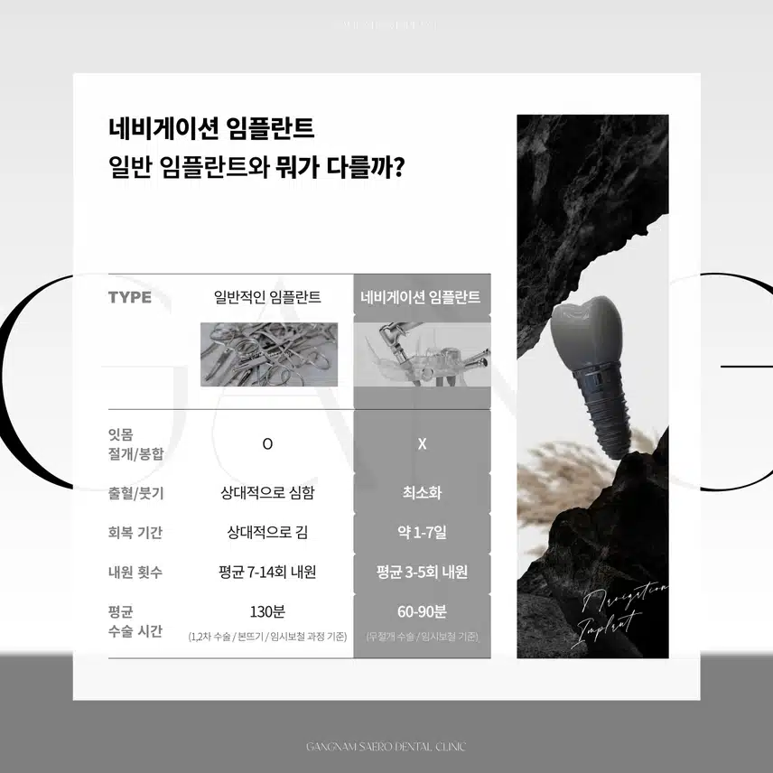 임플란트 부작용/통증/기간 걱정된다면? - 네비게이션 임플란트