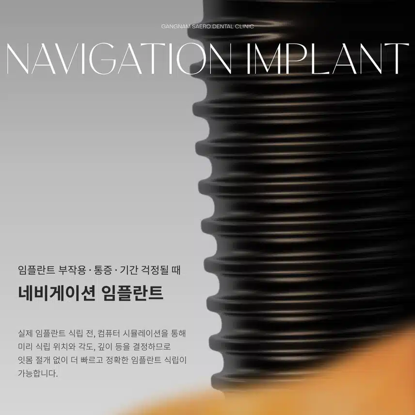 임플란트 부작용/통증/기간 걱정된다면? - 네비게이션 임플란트