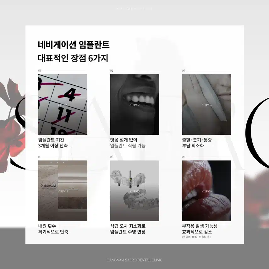 임플란트 부작용/통증/기간 걱정된다면? - 네비게이션 임플란트