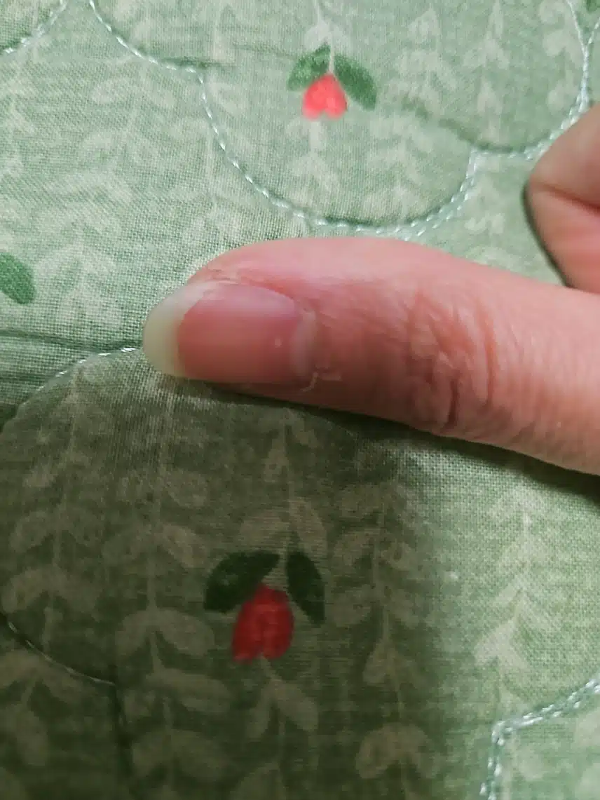 손텁주변에 까끌까끌한 살갖이 생겨나서 고민이에요