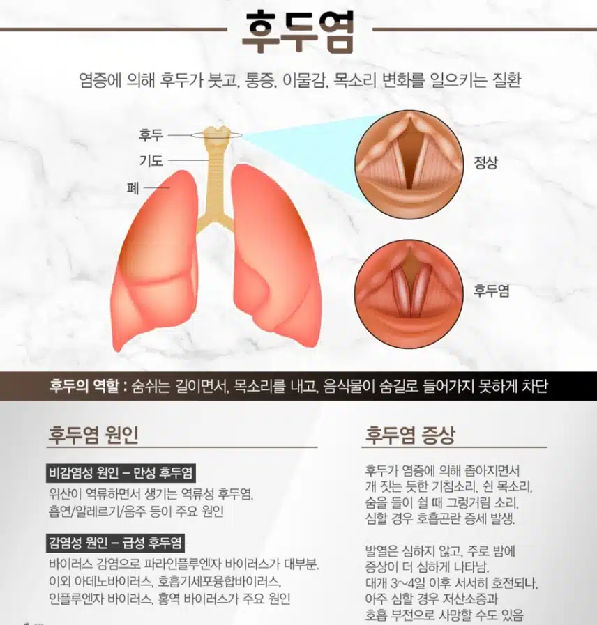 후두염 치료 과정 한 번 들어보실래요?
