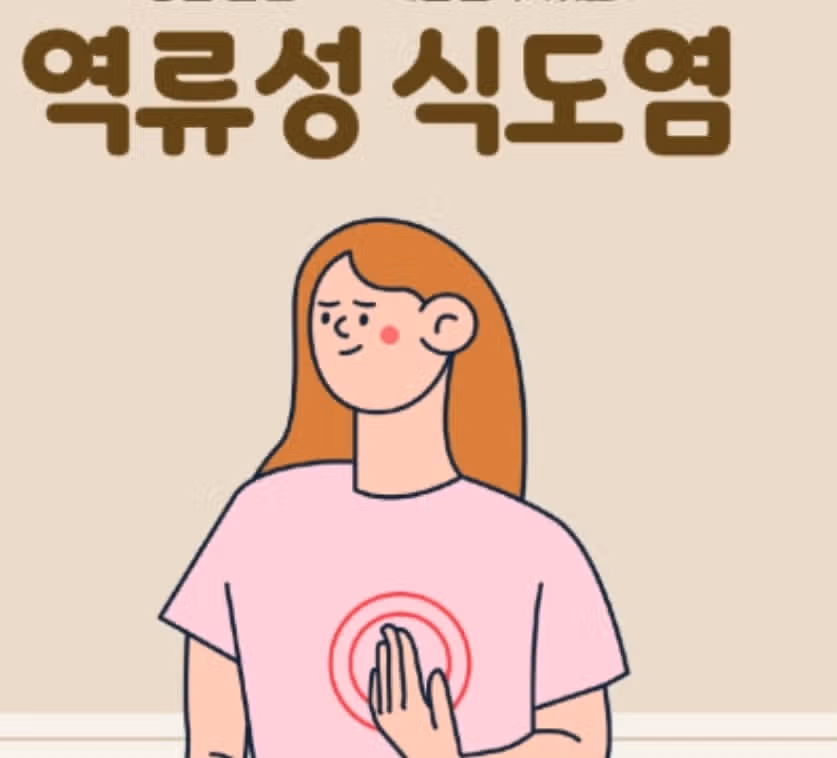 소화불량? 역류성 식도염 증상 중 하나일까요?