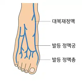간호학과 실습에 꼭 필요한! 정맥주사 부위 그림으로 알아보자!