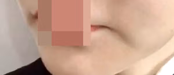 어느새 늘어난 눈가, 입가 잔주름 어떻게 관리하시나요?