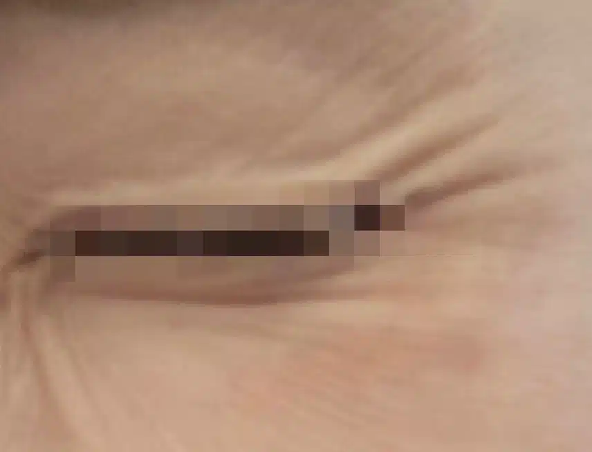 어느새 늘어난 눈가, 입가 잔주름 어떻게 관리하시나요?