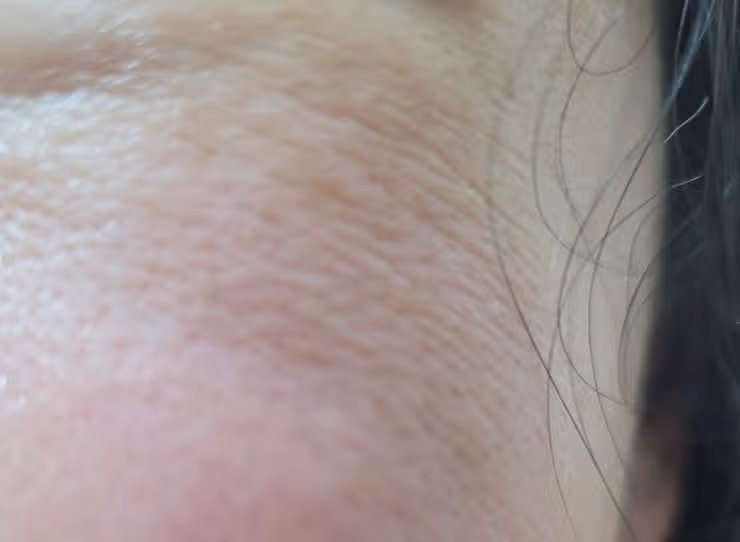 어느새 늘어난 눈가, 입가 잔주름 어떻게 관리하시나요?