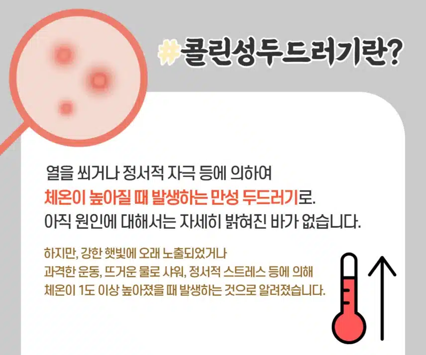 너무 가려운 콜린성 두드러기 해결방법 없을까요?