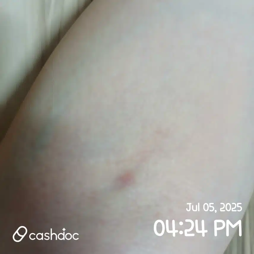 (질문) 피검사 한 당일 샤워 해도 되나요?