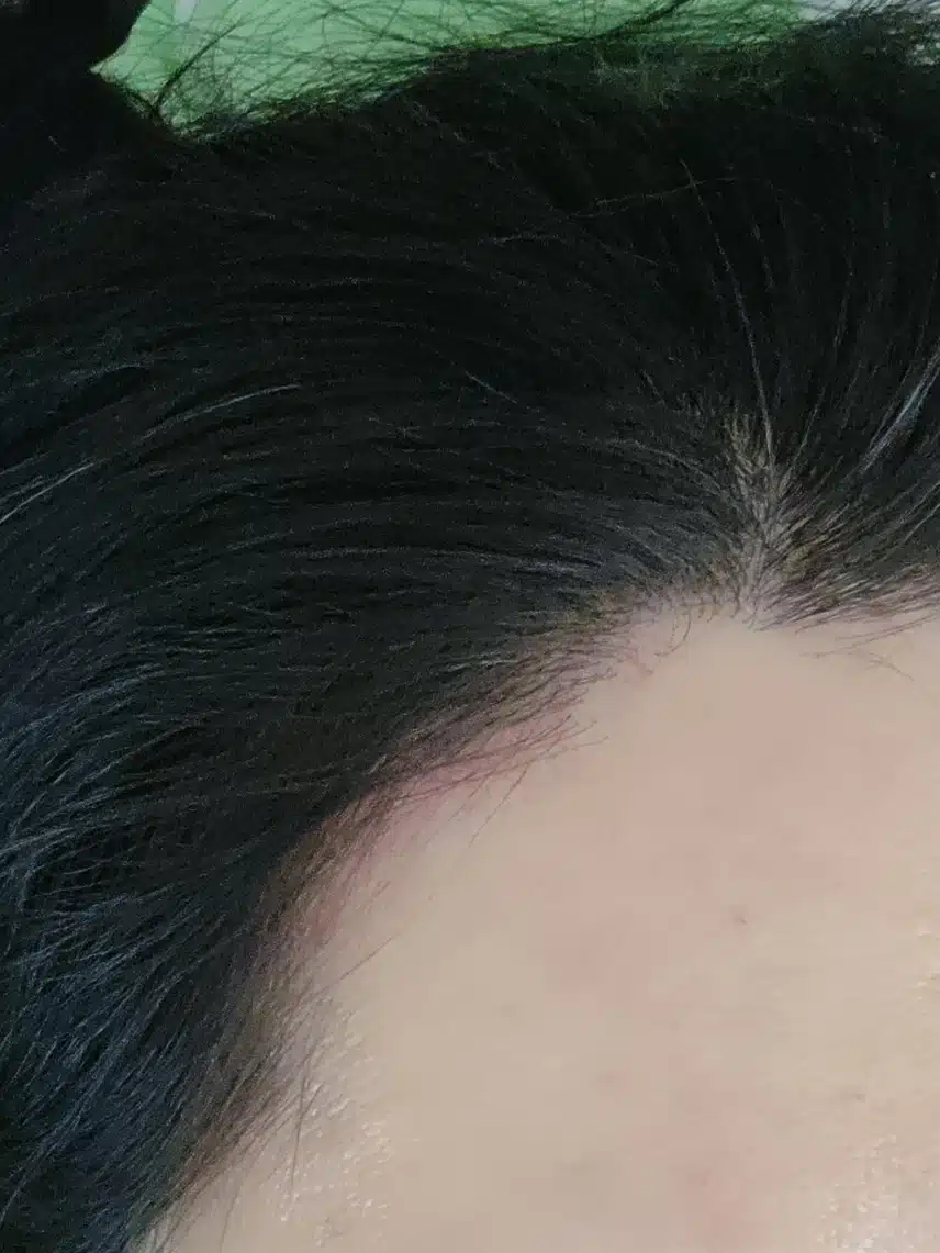 두피에 최대한 자극이 덜가는 염색약 추천받고 싶어요