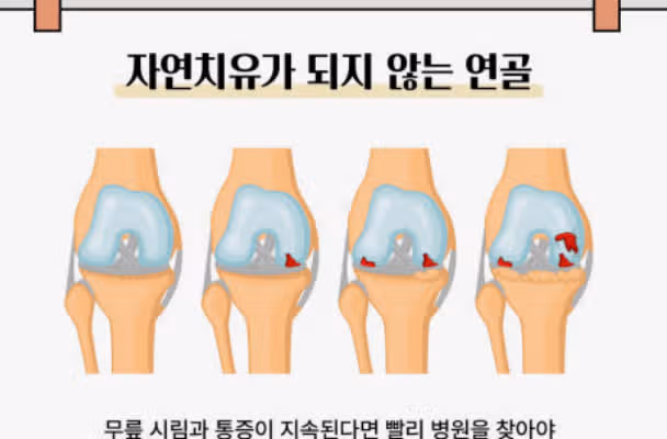 무릎 연골이 상하면 수술해야하나요 ?