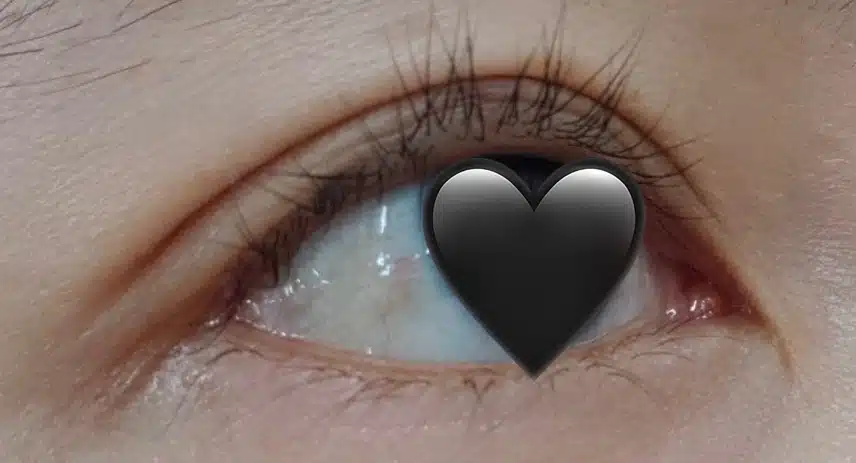 결막염+다래끼 염증 콤보였던 다래끼 치료 후기