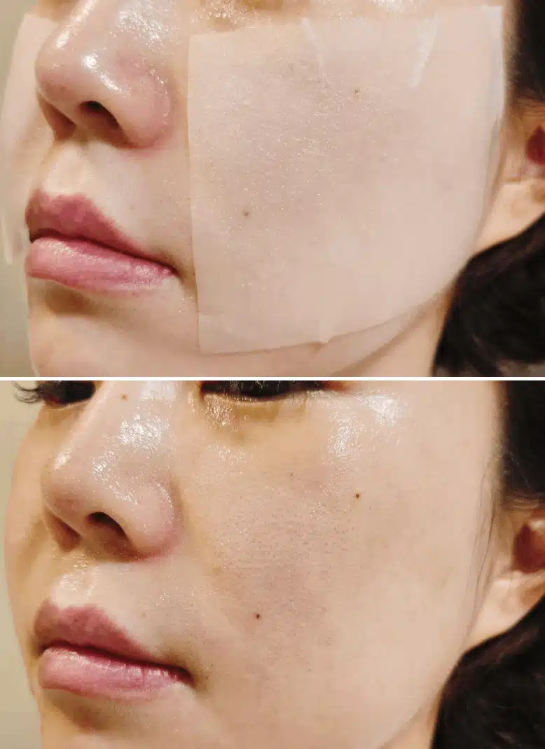 닥터지 하이퍼글로우앰플 필링 & 패드 피부각질케어 솔직후기❤