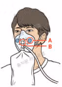 산소마스크 종류별 산소농도와 속도, 특징 및 적용상황 알아보기
