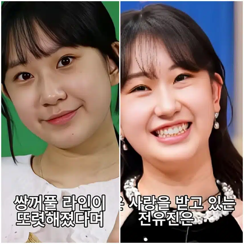 🌺성형 의혹에 시달리는  3명의 트로트가수들