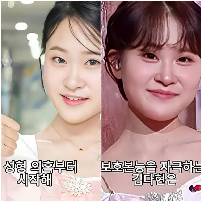 🌺성형 의혹에 시달리는  3명의 트로트가수들