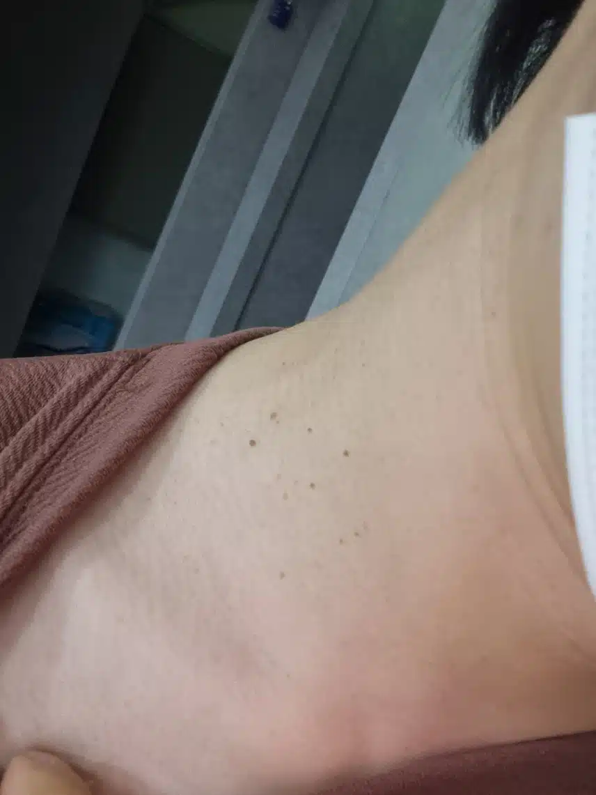 목에 이런것들이 나서 신경쓰이네요.