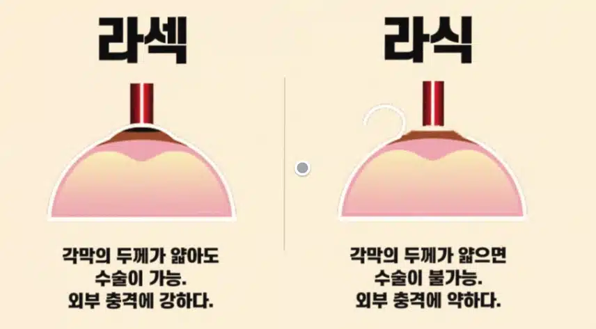 안경 너무 불편해요. 라식, 라섹은 어떤지요?