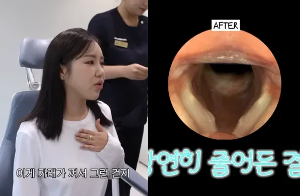 Song Ga-in visited the hospital before the concert