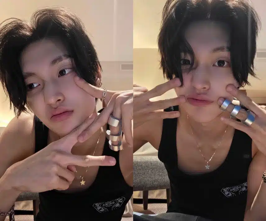Gips jari Won Bin yang menurutnya keren secara diam-diam