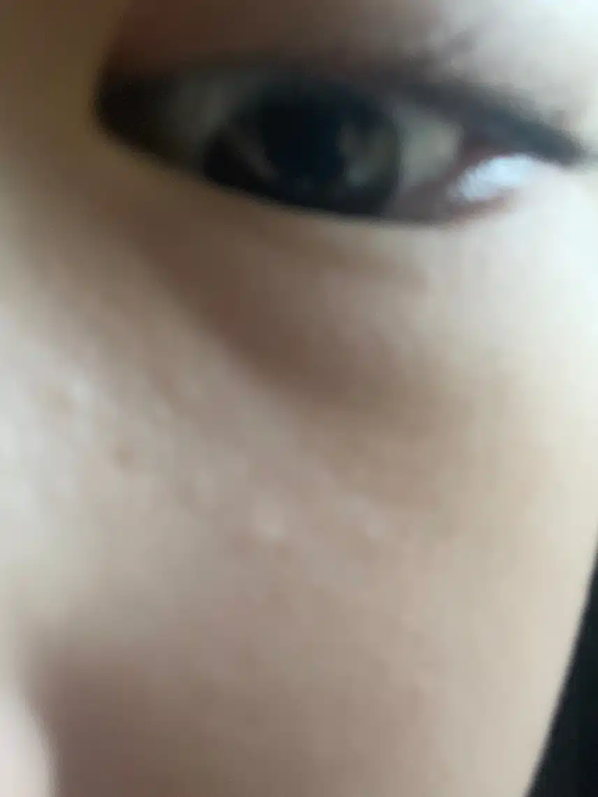 이 다크서클 뭘로 가려야할까요?