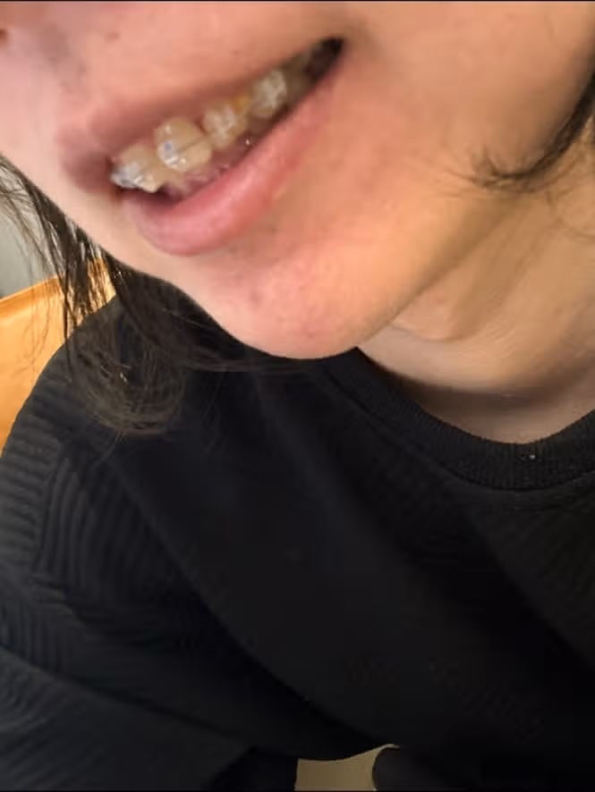 유우키 최근 근황 총정리! 인스타 요리학교 입학 성형 유튜브 복귀 여부