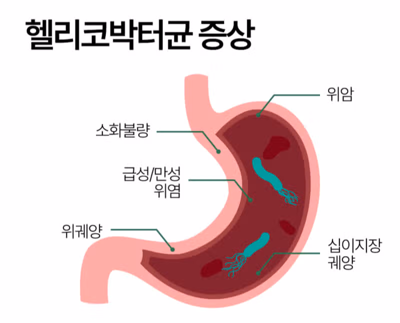 잘려고 누우면 자꾸 헛구역질이 나오는 증상